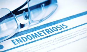 endometriosis blog