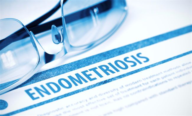 The facts on endometriosis