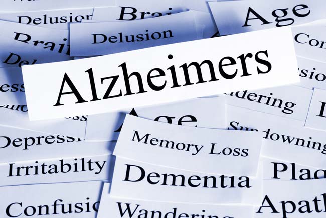 Beyond Memory Loss: Understanding Alzheimer’s Disease