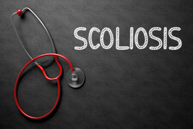 Understanding scoliosis & the signs to watch for