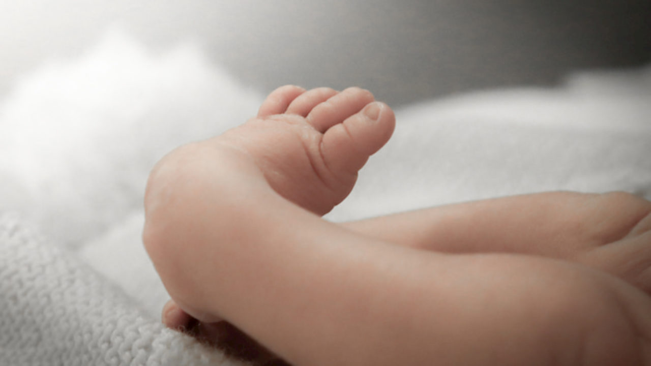 Taking A Look At Clubfoot How It S Treated Healthyu