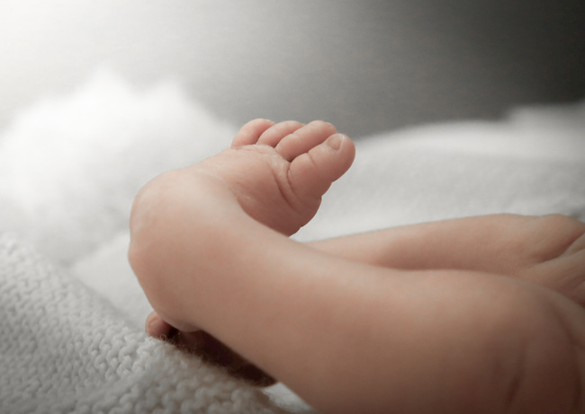 Taking a look at clubfoot & how it’s treated